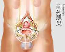 前列腺03