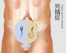 死精症