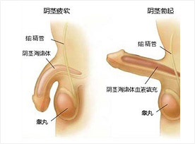 阴茎勃起