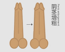 阴茎增粗